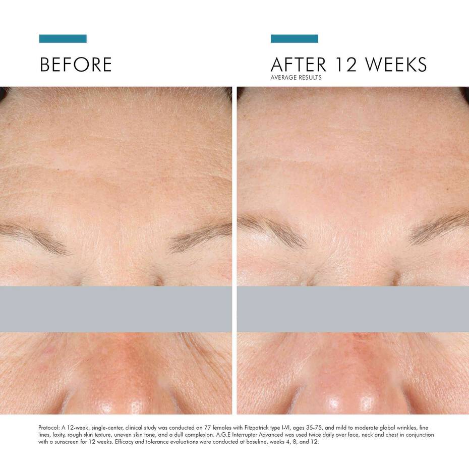 SkinCeuticals A.G.E. INTERRUPTER ADVANCED